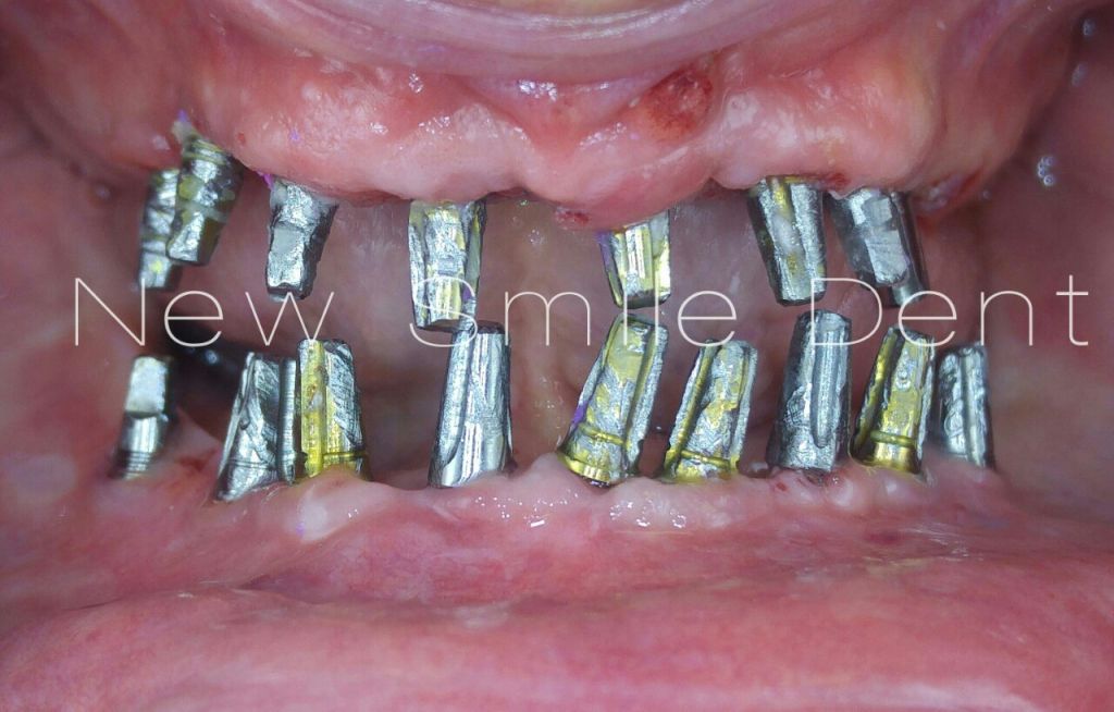 img-44d91021cd15187edc730d3e2588b2b3-v